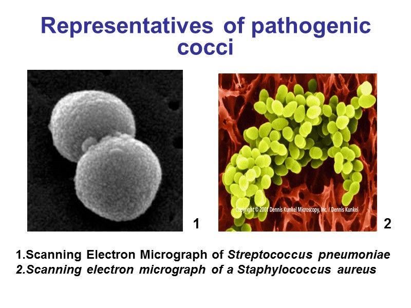 Representatives of pathogenic cocci 1.Scanning Electron Micrograph of Streptococcus pneumoniae 2.Scanning electron micrograph of